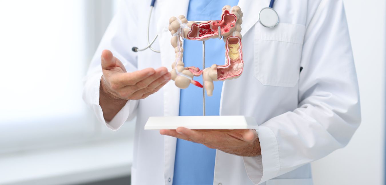 Jak błonnik zmniejsza biegunkę po raku jelita grubego?