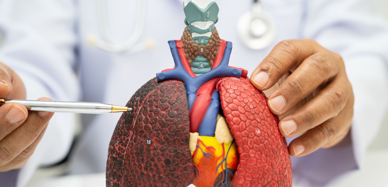 Czy obecne kryteria screeningu raka płuca wykluczają 2/3 pacjent&oacute;w?